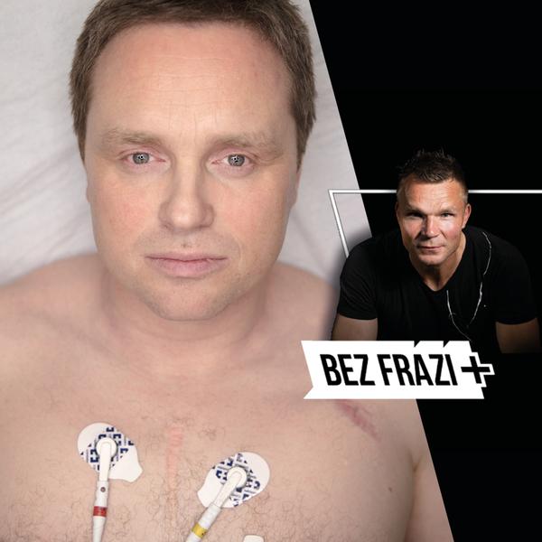 Bez frází+